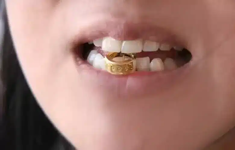 Cách phân biệt vàng giả bằng phương pháp dùng răng cắn vào vàng